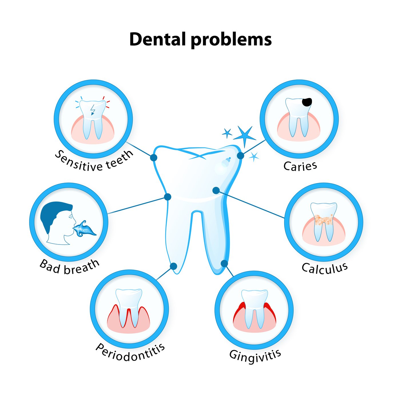 dental problem. Tooth disease: sensitive teeth, caries, calculus, gingivitis, periodontitis and bad breath