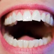 cosmetic dentistry