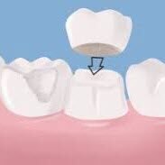 majestic dentists dental crowns {city}