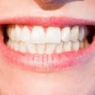 majestic dentists teeth whitening [city}